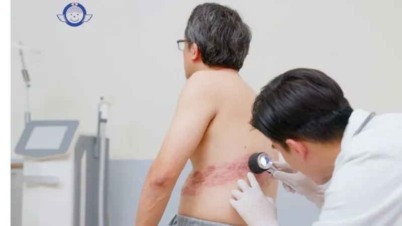 Đối tượng nào có nguy cơ cao mắc bệnh?