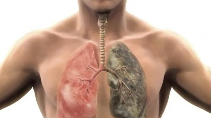 Vậy môi thâm bị bệnh gì?